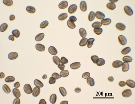 Figura 1: Euphorbia.pulcherrrima-polen
