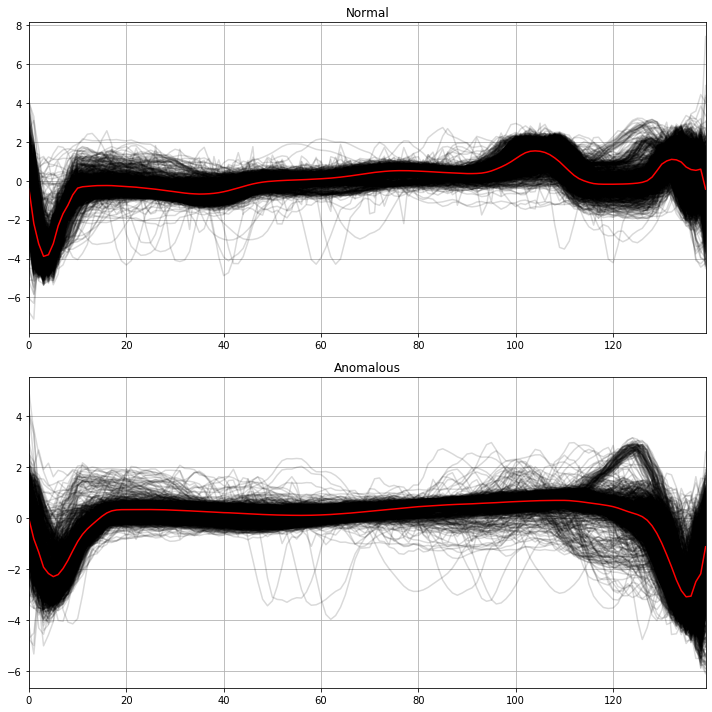 Figura 6. Secuencias del training dataset para latidos normales (arriba) y anómalos (abajo) para TimeSeriesKMeans. En rojo, se observan los centroides de los dos clusters.