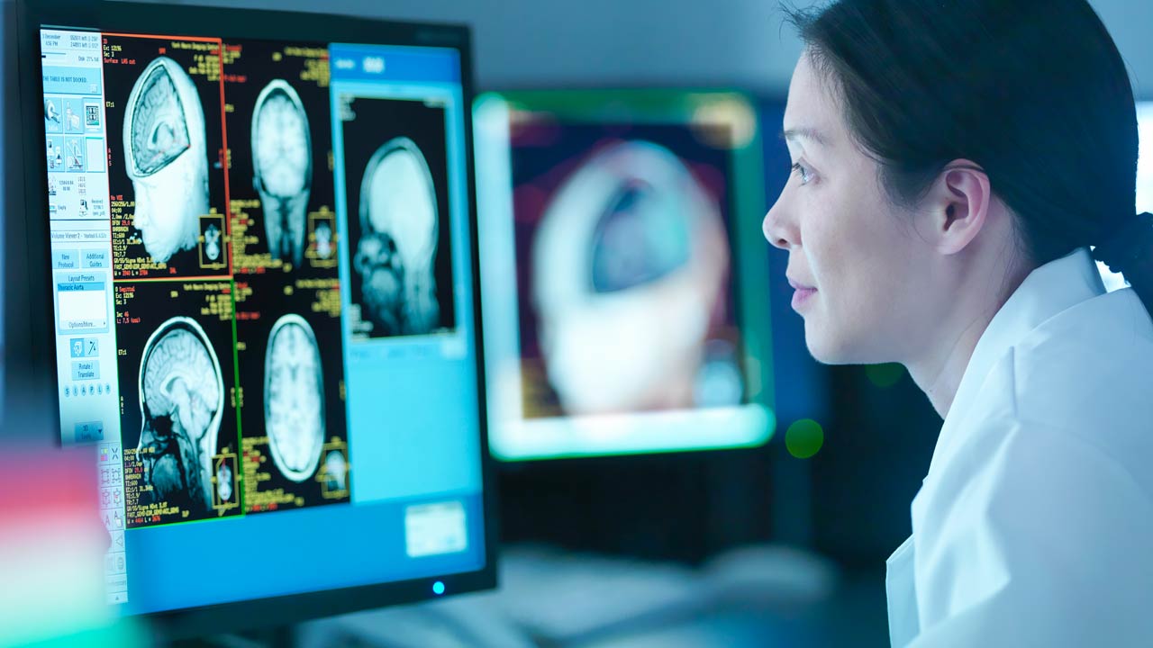 Día Mundial del Cerebro: cómo la IA ayuda en el diagnóstico de patologías neurológicas